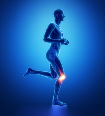 SPRI and Neuromuscular Dynamics Launch NIH-Funded Clinical Trial to Advance Non-Surgical Knee Osteoarthritis Treatment