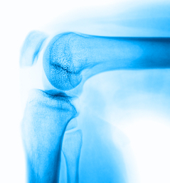  Dr. Robert F. LaPrade Awarded the 2013 OREF Clinical Research Award for his Study on Improving Outcomes for Posterolateral Knee Injuries
